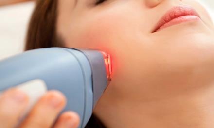 Introducción al principio de la belleza láser